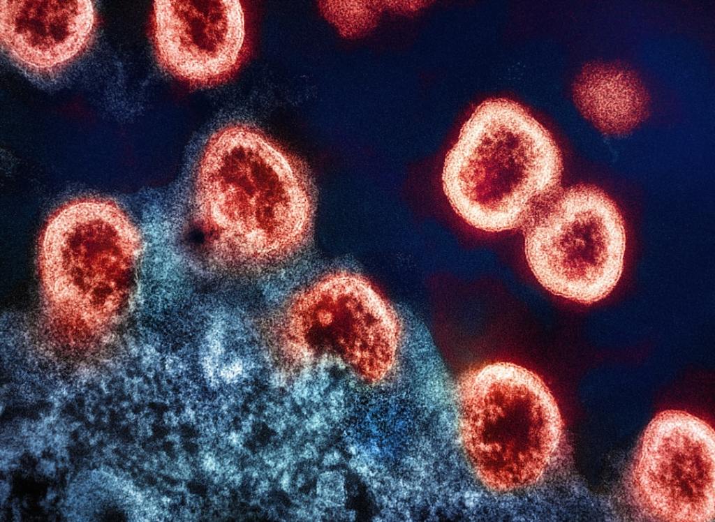 Measles Outbreak Spreads: Cross-Border Crisis&nbsp;Unfolds